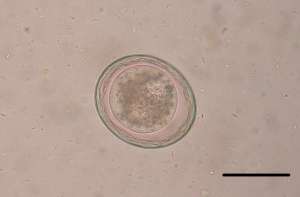 A canine roundworm (Toxascaris leonina) egg. Photo taken through a microscope at 400x. Scale bar = 50 micrometres