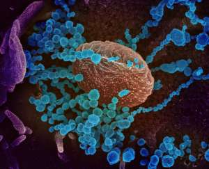 This scanning electron microscope image shows SARS-CoV-2 (round blue objects) emerging from the surface of cells cultured in the lab.